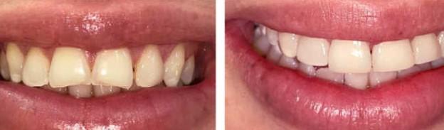 cosmetic-dentistry-yarraville