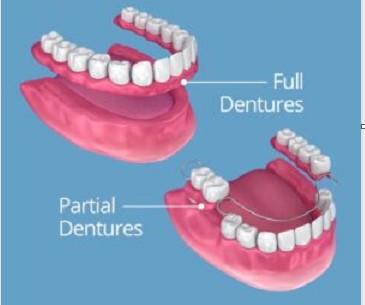 denture-denturist-in-yaraville-melbourne